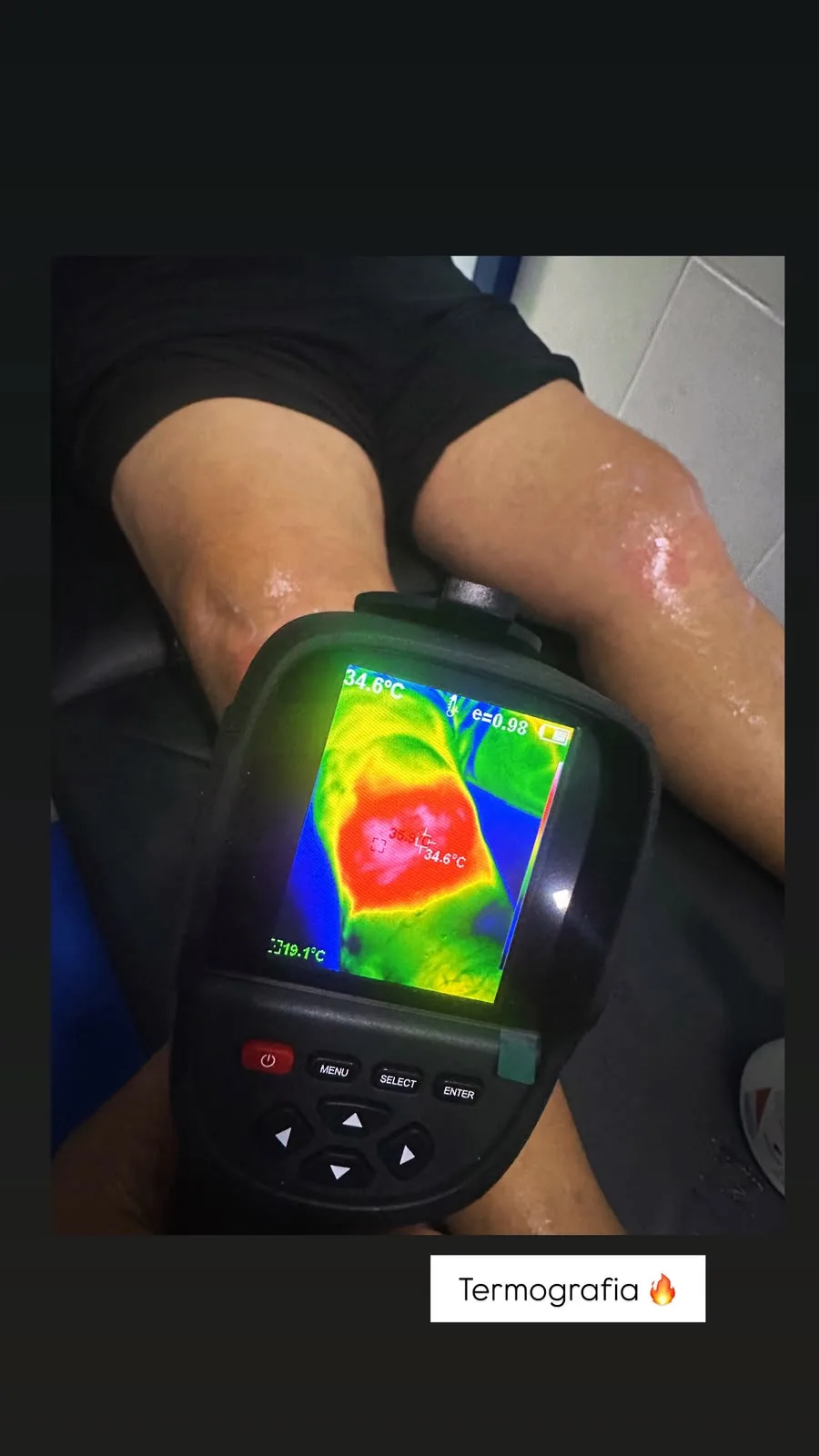 Termografia identificando inflamação