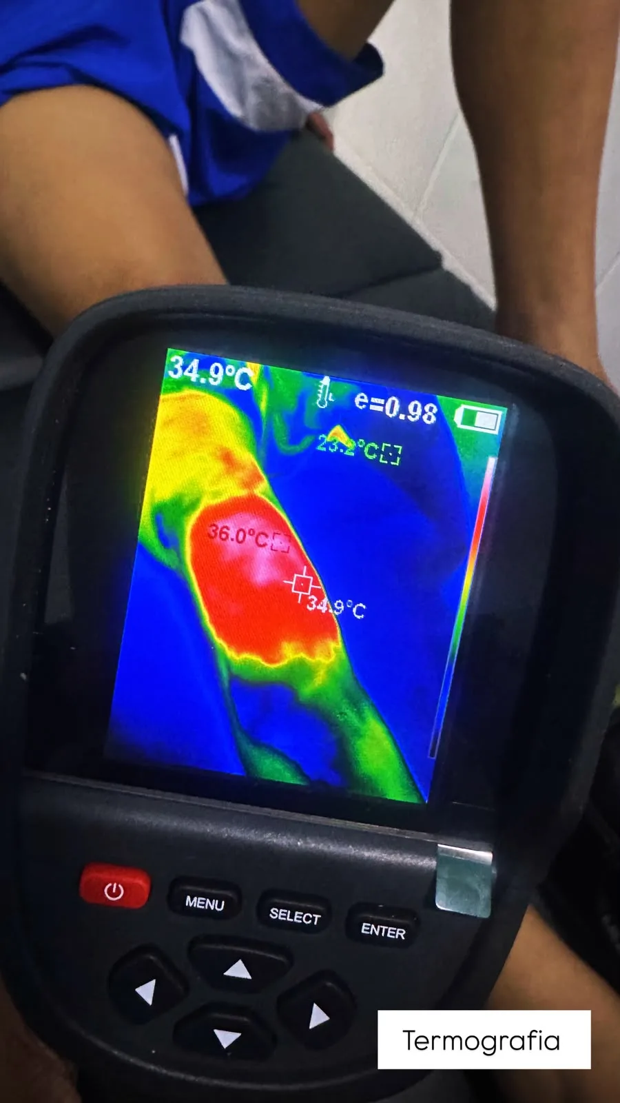 Termografia em atendimento